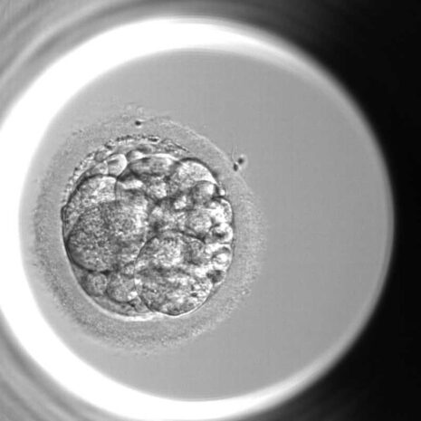 あなたの大切な卵と胚培養(受精、そして分割期胚から桑実胚、胚盤胞) | 上野の不妊治療・体外受精 | よしひろウィメンズクリニック