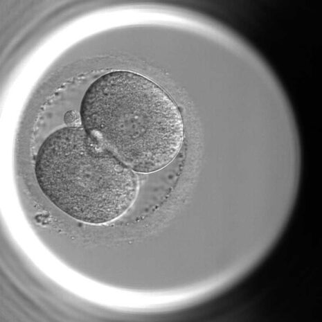 あなたの大切な卵と胚培養(受精、そして分割期胚から桑実胚、胚盤胞) | 上野の不妊治療・体外受精 | よしひろウィメンズクリニック