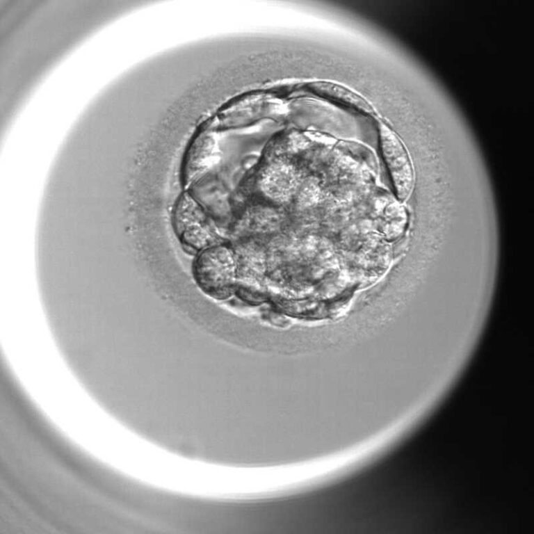 あなたの大切な卵と胚培養(受精、そして分割期胚から桑実胚、胚盤胞) | 上野の不妊治療・体外受精 | よしひろウィメンズクリニック