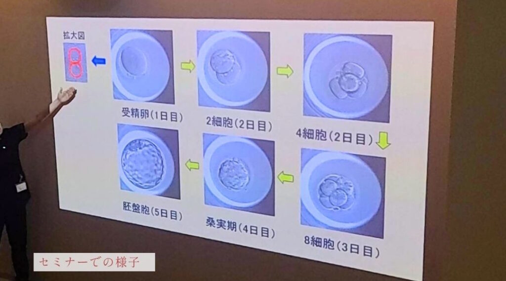 セミナーで受精卵から胚盤胞までの成長過程のスライドを解説する様子